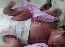 第三代试管助孕费用贵不贵一般多少钱？