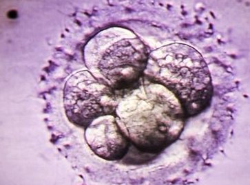 赤峰私立试管婴儿医院推荐，想做不妨试试这两所机构